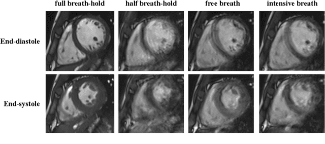 Figure 1 for The Extreme Cardiac MRI Analysis Challenge under Respiratory Motion (CMRxMotion)