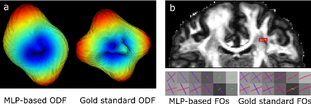 Figure 1 for Learning-based Ensemble Average Propagator Estimation