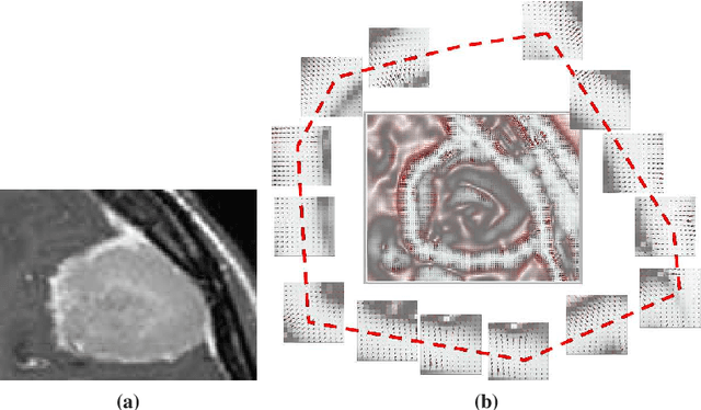 Figure 1 for Active Contour with A Tangential Component