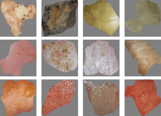 Figure 3 for Multiclass Burn Wound Image Classification Using Deep Convolutional Neural Networks