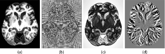 Figure 1 for Deformable Registration Using Average Geometric Transformations for Brain MR Images