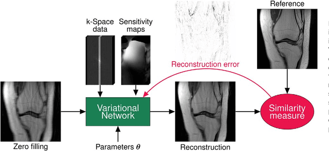 Figure 2 for Learning a Variational Network for Reconstruction of Accelerated MRI Data