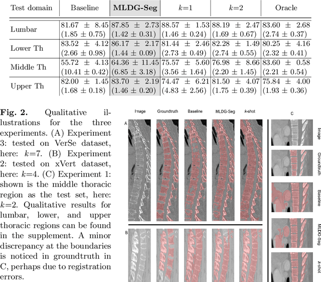 Figure 3 for Domain Generalizer: A Few-shot Meta Learning Framework for Domain Generalization in Medical Imaging