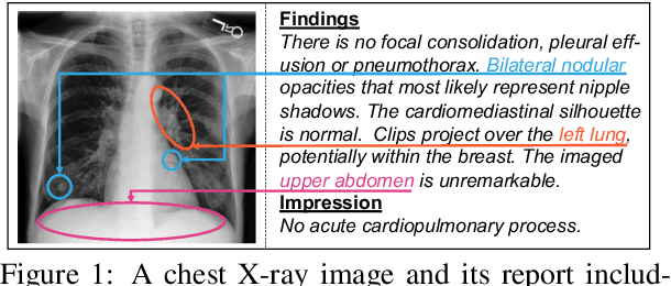 Figure 1 for Cross-modal Memory Networks for Radiology Report Generation