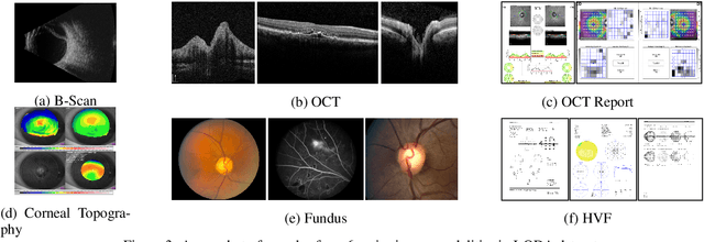 Figure 3 for I-ODA, Real-World Multi-modal Longitudinal Data for OphthalmicApplications
