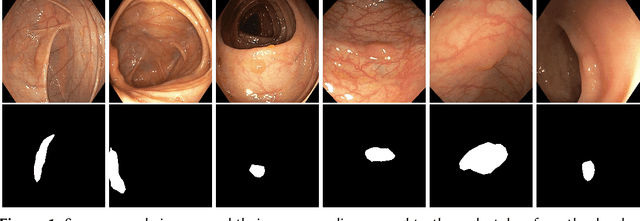 Figure 1 for DivergentNets: Medical Image Segmentation by Network Ensemble