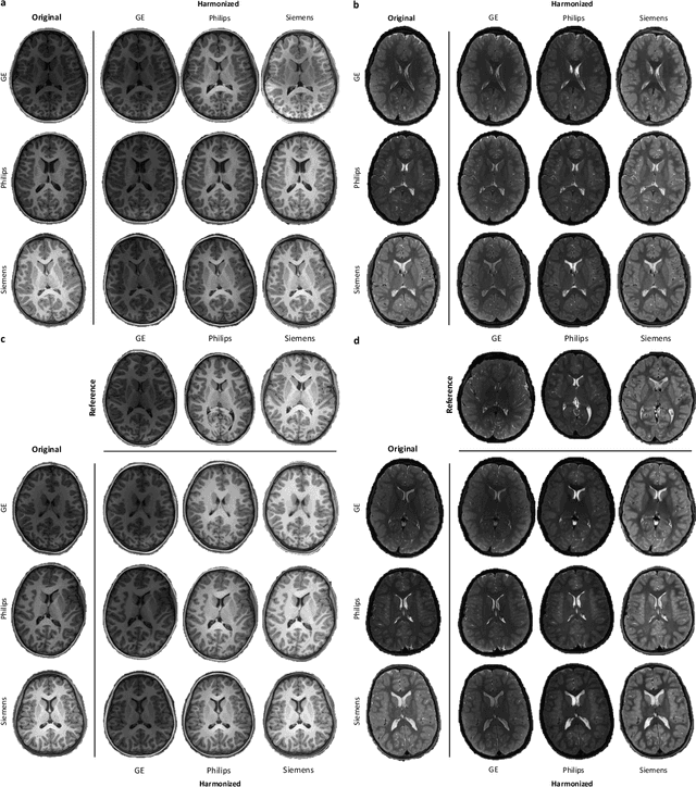 Figure 3 for Learning Multi-Site Harmonization of Magnetic Resonance Images Without Traveling Human Phantoms