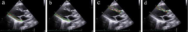 Figure 3 for Trilateral Attention Network for Real-time Medical Image Segmentation
