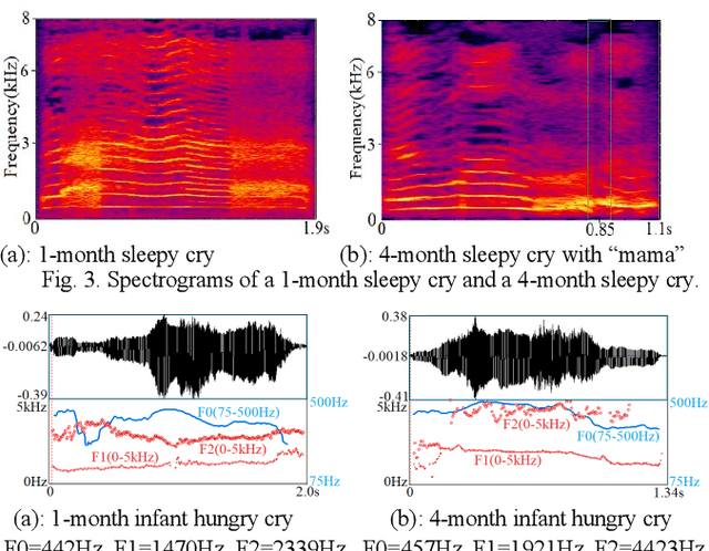 Figure 3 for Infant Vocal Tract Development Analysis and Diagnosis by Cry Signals with CNN Age Classification