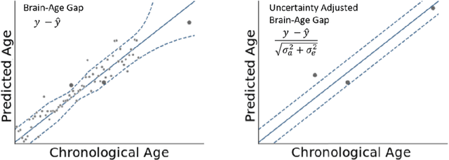 Figure 1 for An Uncertainty-Aware, Shareable and Transparent Neural Network Architecture for Brain-Age Modeling