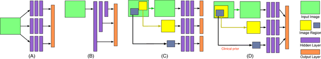 Figure 2 for Angle-Closure Detection in Anterior Segment OCT based on Multi-Level Deep Network