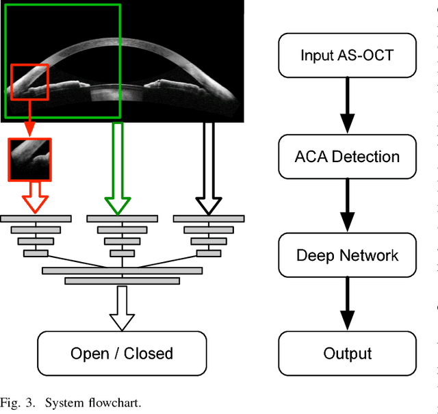 Figure 3 for Angle-Closure Detection in Anterior Segment OCT based on Multi-Level Deep Network