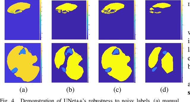 Figure 4 for Learning of Inter-Label Geometric Relationships Using Self-Supervised Learning: Application To Gleason Grade Segmentation
