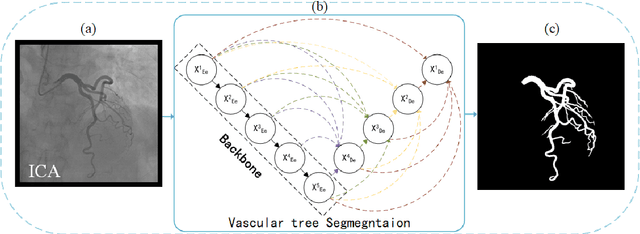 Figure 1 for Automatic extraction of coronary arteries using deep learning in invasive coronary angiograms