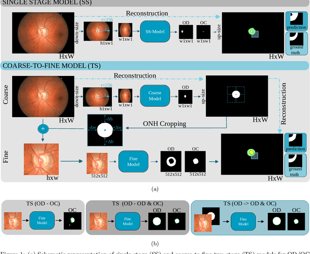 Figure 1 for Assessing Coarse-to-Fine Deep Learning Models for Optic Disc and Cup Segmentation in Fundus Images
