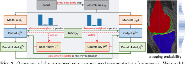 Figure 3 for Calibrating Label Distribution for Class-Imbalanced Barely-Supervised Knee Segmentation