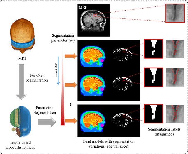 Figure 1 for Influence of segmentation accuracy in structural MR head scans on electric field computation for TMS and tES