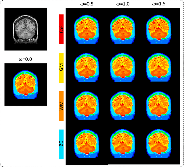 Figure 2 for Influence of segmentation accuracy in structural MR head scans on electric field computation for TMS and tES