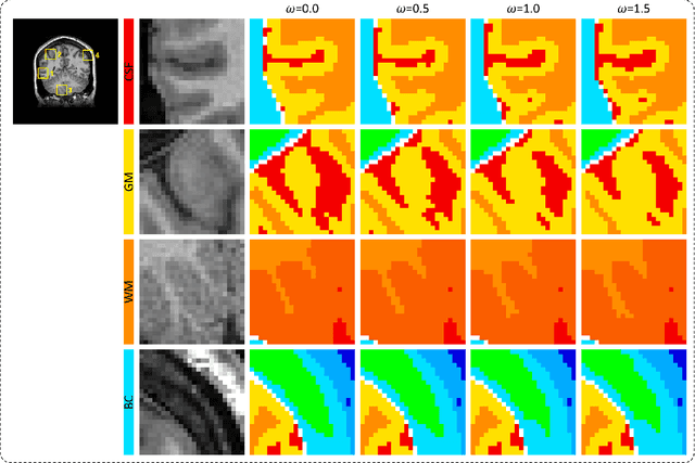 Figure 3 for Influence of segmentation accuracy in structural MR head scans on electric field computation for TMS and tES