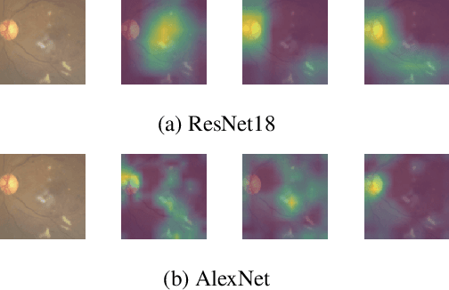 Figure 4 for When Differential Privacy Meets Interpretability: A Case Study