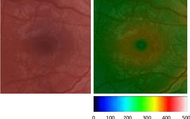 Figure 1 for Analysis of Macula on Color Fundus Images Using Heightmap Reconstruction Through Deep Learning