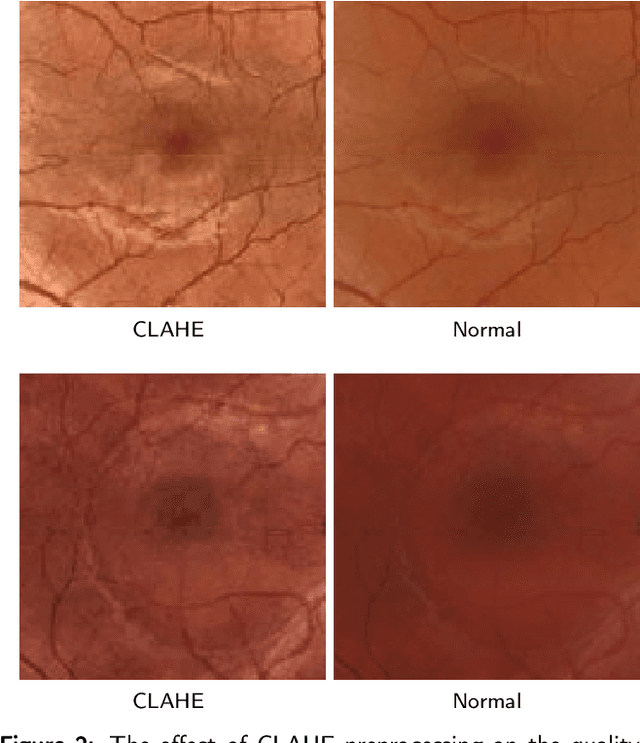 Figure 2 for Analysis of Macula on Color Fundus Images Using Heightmap Reconstruction Through Deep Learning