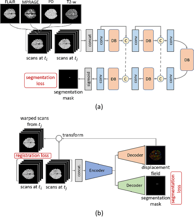 Figure 1 for Spatio-temporal Learning from Longitudinal Data for Multiple Sclerosis Lesion Segmentation