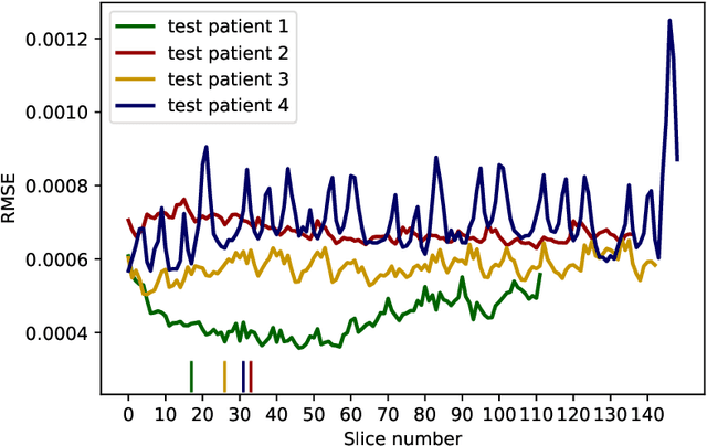 Figure 4 for 3D helical CT reconstruction with memory efficient invertible Learned Primal-Dual method