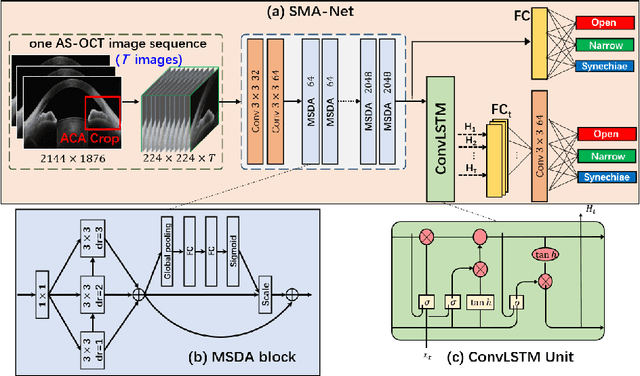 Figure 3 for Open-Narrow-Synechiae Anterior Chamber Angle Classification in AS-OCT Sequences