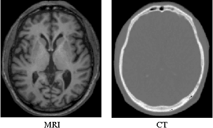 Figure 1 for Medical Image Synthesis with Context-Aware Generative Adversarial Networks