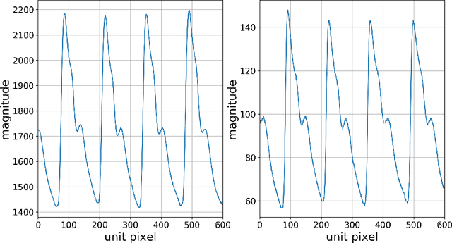 Figure 3 for A machine learning method correlating pulse pressure wave data with pregnancy