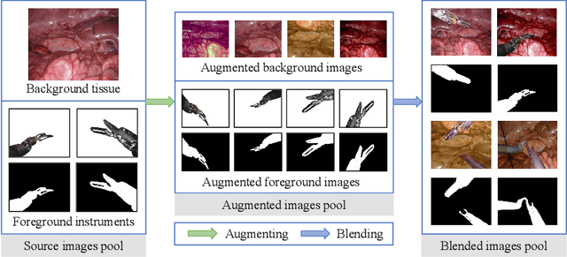 Figure 1 for Rethinking Surgical Instrument Segmentation: A Background Image Can Be All You Need