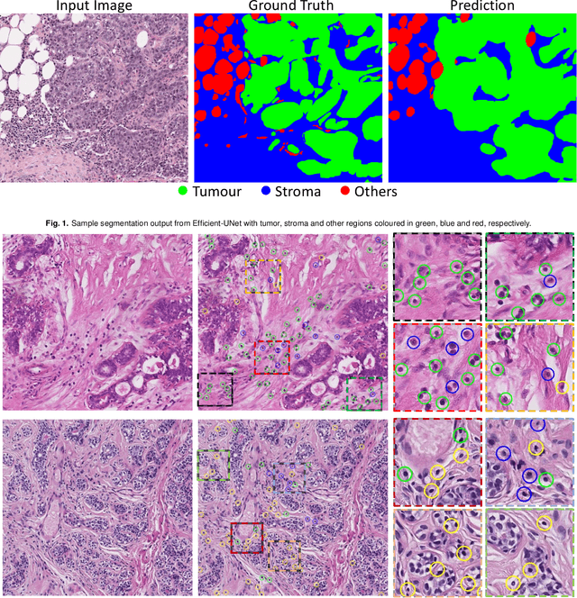 Figure 1 for TIAger: Tumor-Infiltrating Lymphocyte Scoring in Breast Cancer for the TiGER Challenge
