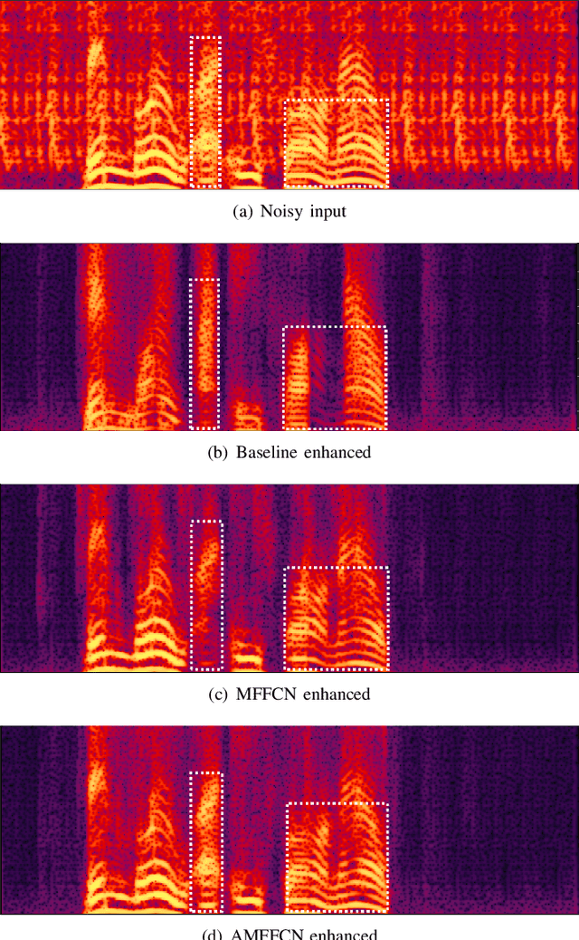 Figure 3 for Attentional Multi-layer Feature Fusion Convolution Network for Audio-visual Speech Enhancement