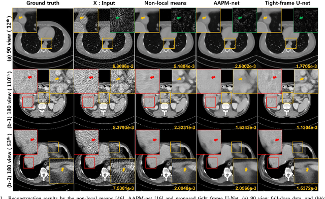 Figure 3 for Framing U-Net via Deep Convolutional Framelets: Application to Sparse-view CT