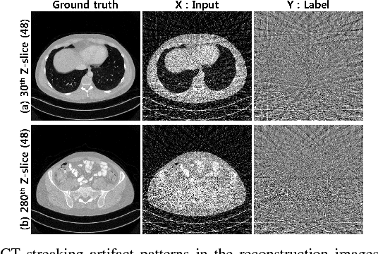 Figure 1 for Framing U-Net via Deep Convolutional Framelets: Application to Sparse-view CT