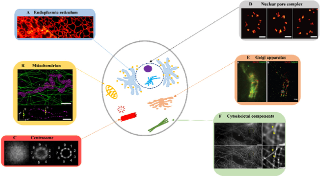 Figure 2 for Advancing biological super-resolution microscopy through deep learning: a brief review
