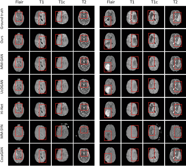Figure 3 for A Novel Unified Conditional Score-based Generative Framework for Multi-modal Medical Image Completion