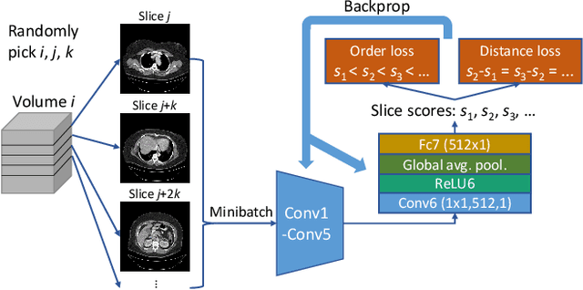 Figure 1 for Unsupervised Body Part Regression via Spatially Self-ordering Convolutional Neural Networks