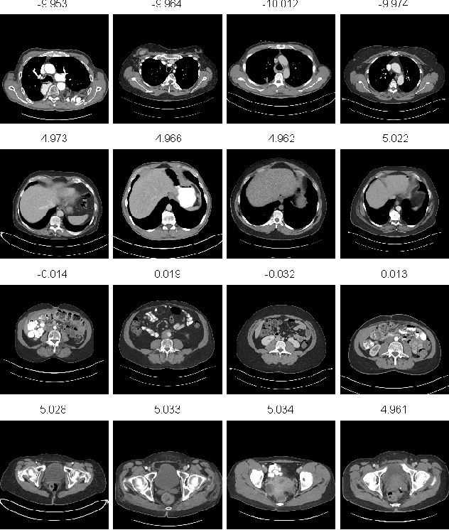 Figure 3 for Unsupervised Body Part Regression via Spatially Self-ordering Convolutional Neural Networks