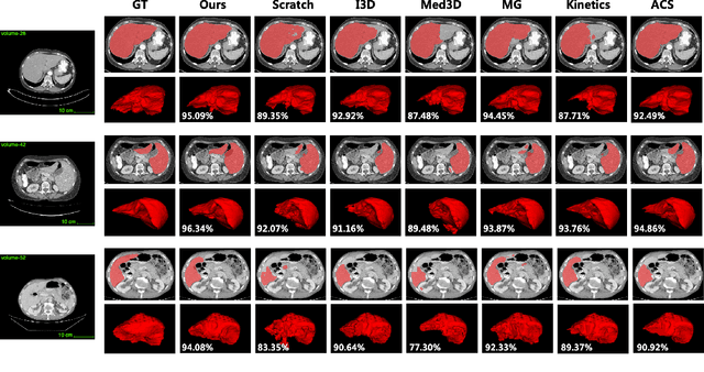 Figure 2 for Advancing 3D Medical Image Analysis with Variable Dimension Transform based Supervised 3D Pre-training
