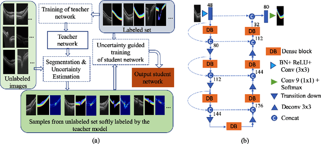 Figure 1 for Uncertainty guided semi-supervised segmentation of retinal layers in OCT images