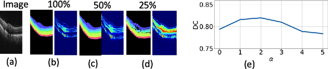 Figure 2 for Uncertainty guided semi-supervised segmentation of retinal layers in OCT images