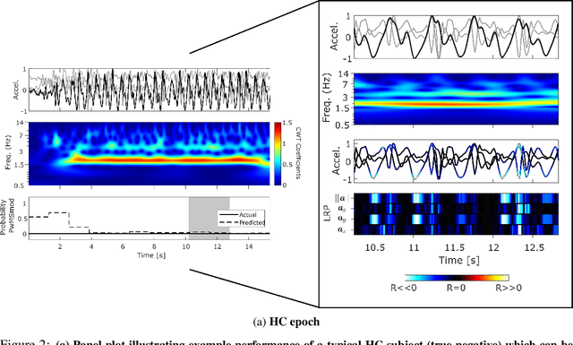 Figure 4 for Interpretable Deep Learning for the Remote Characterisation of Ambulation in Multiple Sclerosis using Smartphones