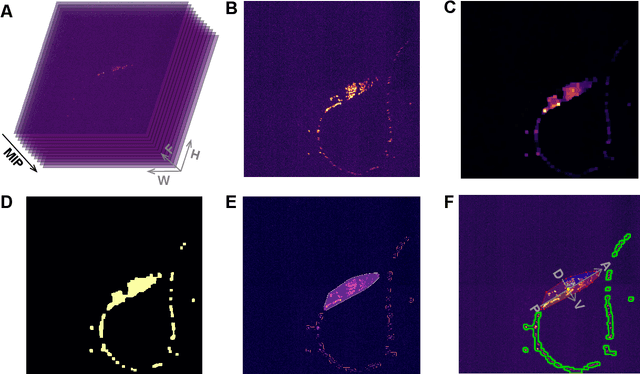 Figure 3 for Rapid detection and recognition of whole brain activity in a freely behaving Caenorhabditis elegans