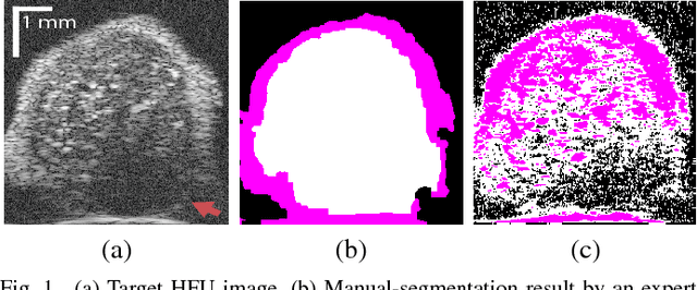 Figure 1 for Segmentation of 3D High-frequency Ultrasound Images of Human Lymph Nodes Using Graph Cut with Energy Functional Adapted to Local Intensity Distribution