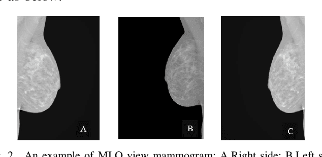 Figure 2 for Using Machine Learning to Automate Mammogram Images Analysis
