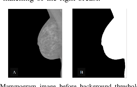 Figure 3 for Using Machine Learning to Automate Mammogram Images Analysis