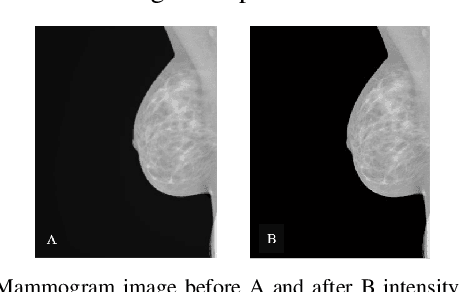 Figure 4 for Using Machine Learning to Automate Mammogram Images Analysis