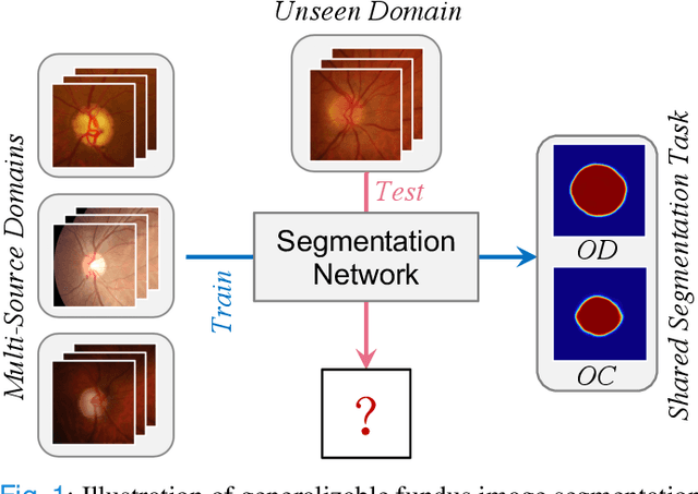 Figure 1 for DoFE: Domain-oriented Feature Embedding for Generalizable Fundus Image Segmentation on Unseen Datasets